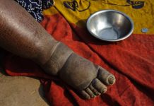 African Media Step up for Neglected Tropical Diseases