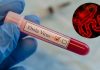 Uganda Tightens Ebola Surveillance as DR Congo Outbreak Sparks Regional Concern