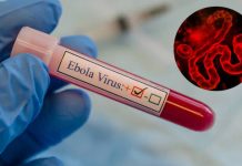 Uganda Tightens Ebola Surveillance as DR Congo Outbreak Sparks Regional Concern